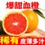 飓香园 四川塔罗科血橙5斤中果 单果60-65mm 富含花青素的水果